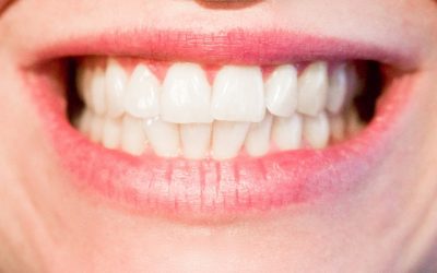 Monroe, MI Dentist | The Dangers of Grinding