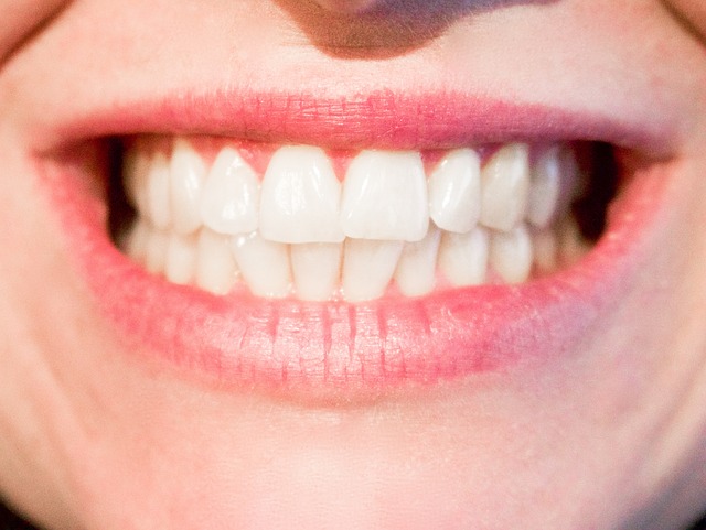 Monroe, MI Dentist | The Dangers of Grinding