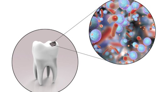 Constantly Getting Cavities? We May Know Why