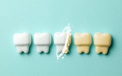 4 Foods That Can Whiten Your Teeth