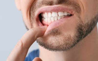 Are Your Teeth Feeling Numb and Tingly?