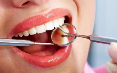 The Different Types of Dental Bridges