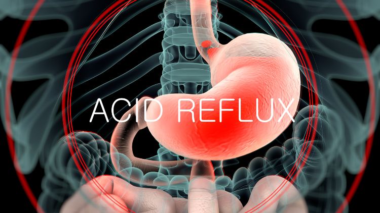 Hope for heartburn: 'Bracelet' implant for the throat can help treat severe acid  reflux - National | Globalnews.ca