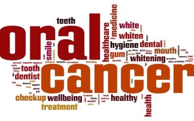 Oral Cancer Screening – What’s the Importance?