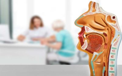 What Are the Signs of a Cavity, and How Can I Avoid Them?