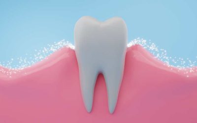 Best Toothpaste for Receding Gums: Protecting Your Oral Health